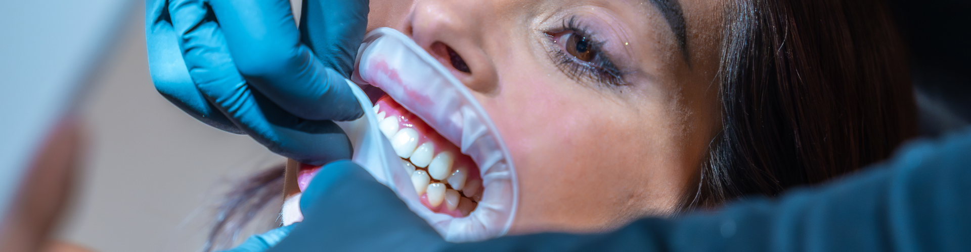  Middle Village Teeth Cleaning