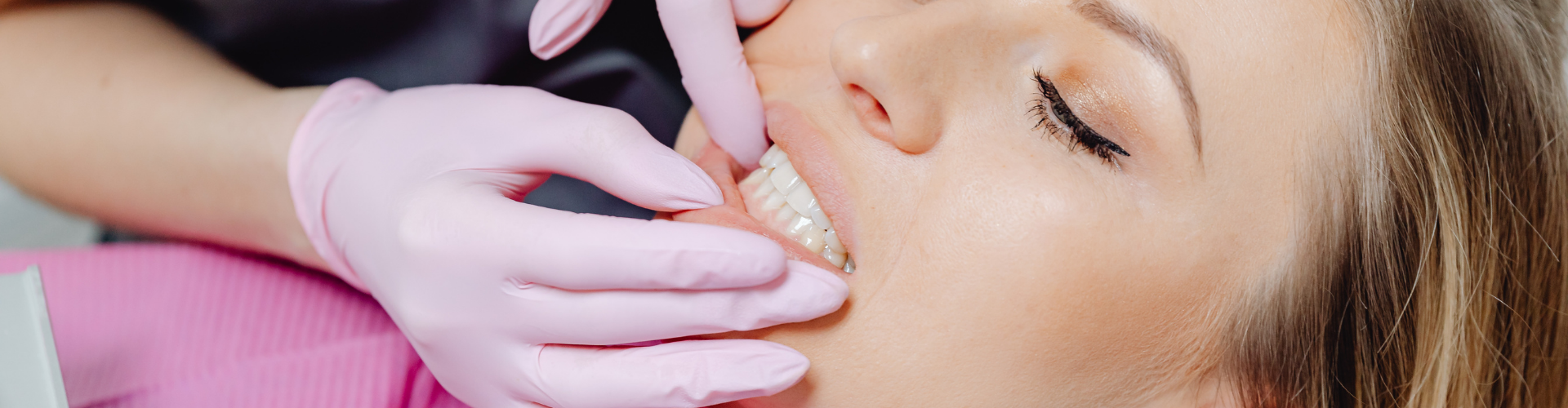  Rego Park Teeth Whitening