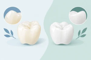 Ceramic Versus Zirconia Crowns: Which Fits?