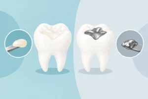 Composite Versus Amalgam Fillings: Which Fits?